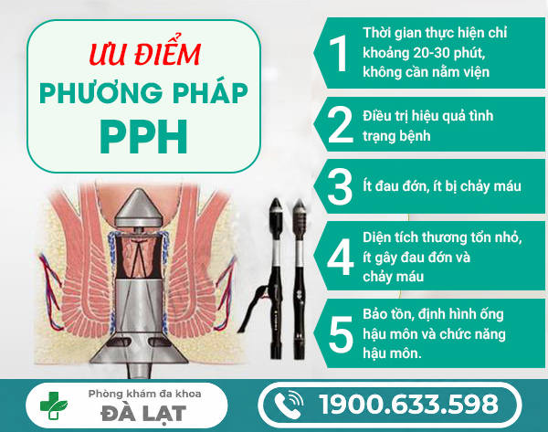 Hình ảnh minh họa